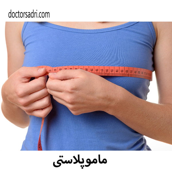 ماموپلاستی - دکتر پیمان صدری