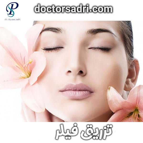 تزریق فیلر با دکتر صدری در تهران