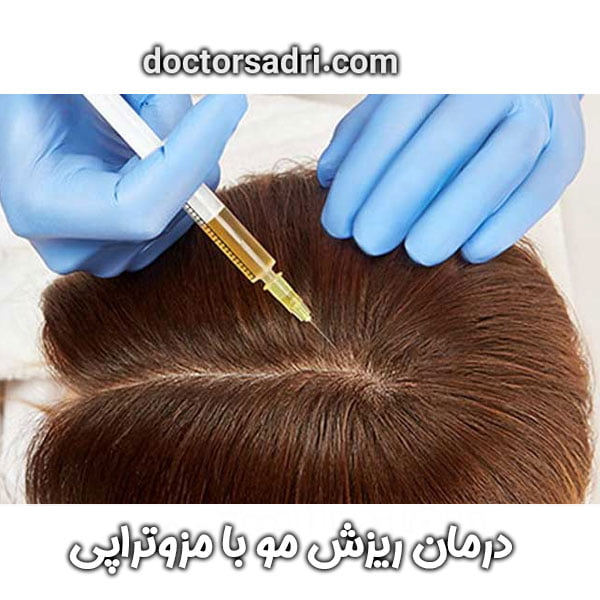 مزوتراپی مو دکتر صدری در تهران