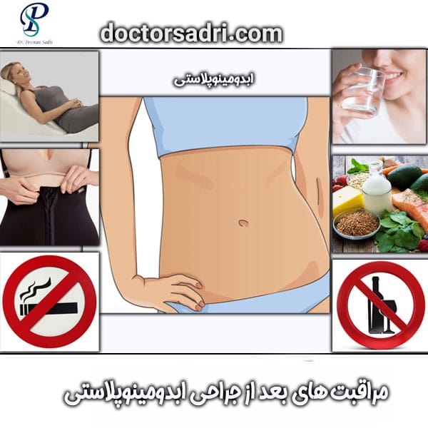 مراقبت های بعداز جراحی ابدومینوپلاستی دکتر پیمان صدری ، بهترین جراح جنرال تهران