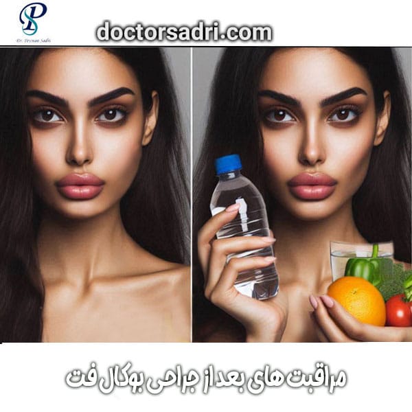 مراقبت های بعد از جراحی بوکال فت دکتر پیمان صدری بهترین جراح جنرال تهران