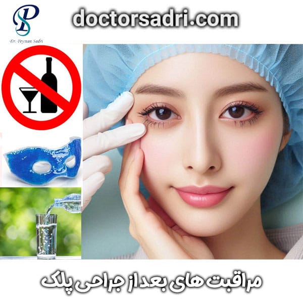 مراقبت های بعد ازجراحی پلک از دکتر پیمان صدری در تهران