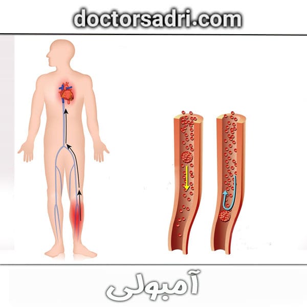 آمبولی از دکتر پیمان صدری ، بهترین جراح جنرال تهران