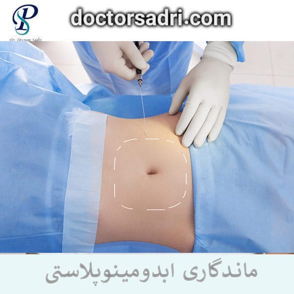 ماندگاری ابدومینوپلاستی _ دکتر پیمان صدری