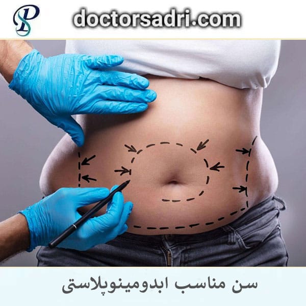 سن مناسب ابدومینوپلاستی _ دکتر پیمان صدری