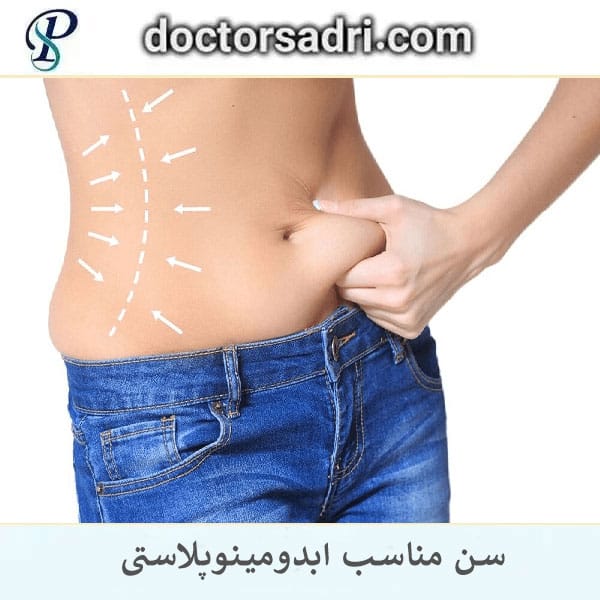 سن مناسب ابدومینوپلاستی _ دکتر پیمان صدری