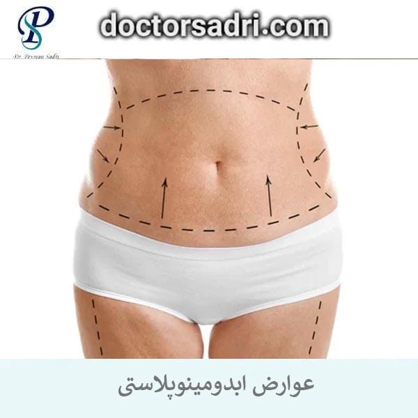 عوارض ابدومینوپلاستی _ دکتر پیمان صدری