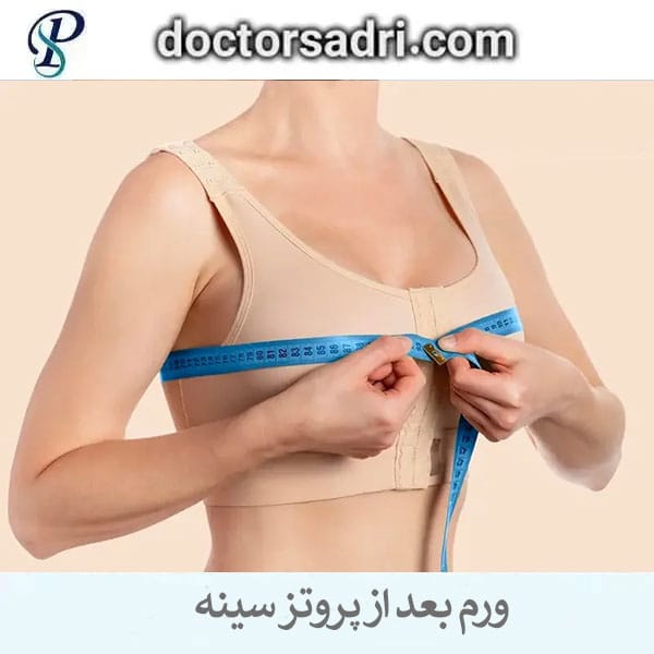 ورم بعد از عمل پروتز سینه _ دکتر پیمان صدری